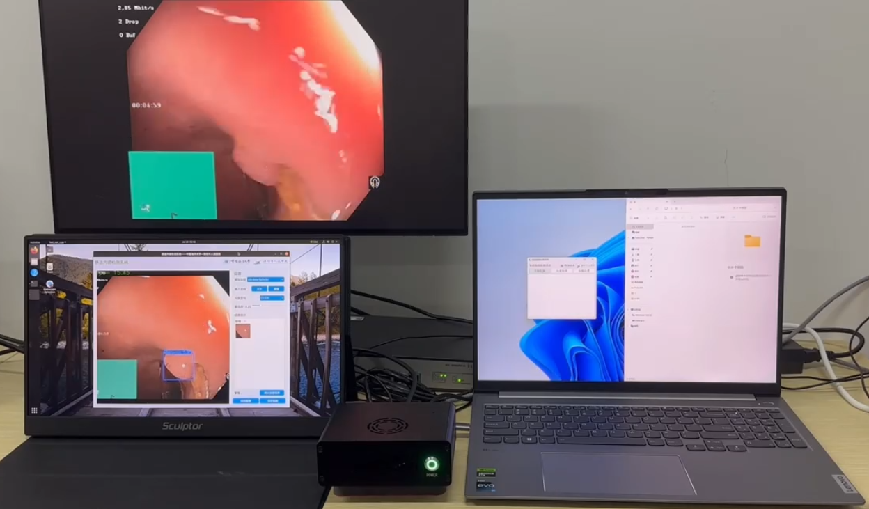 肠镜智能检测系统