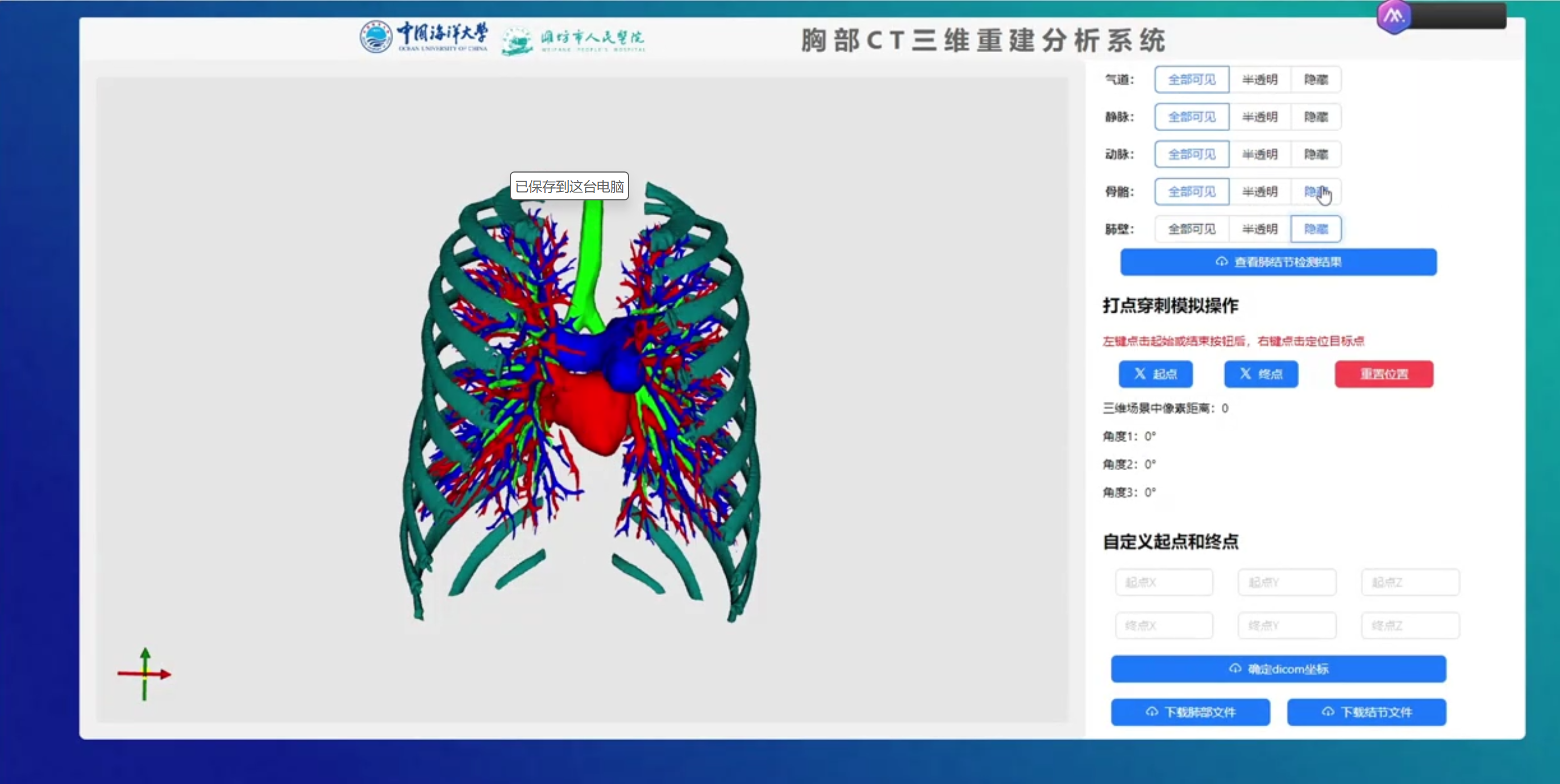 胸部CT三维重建分析系统